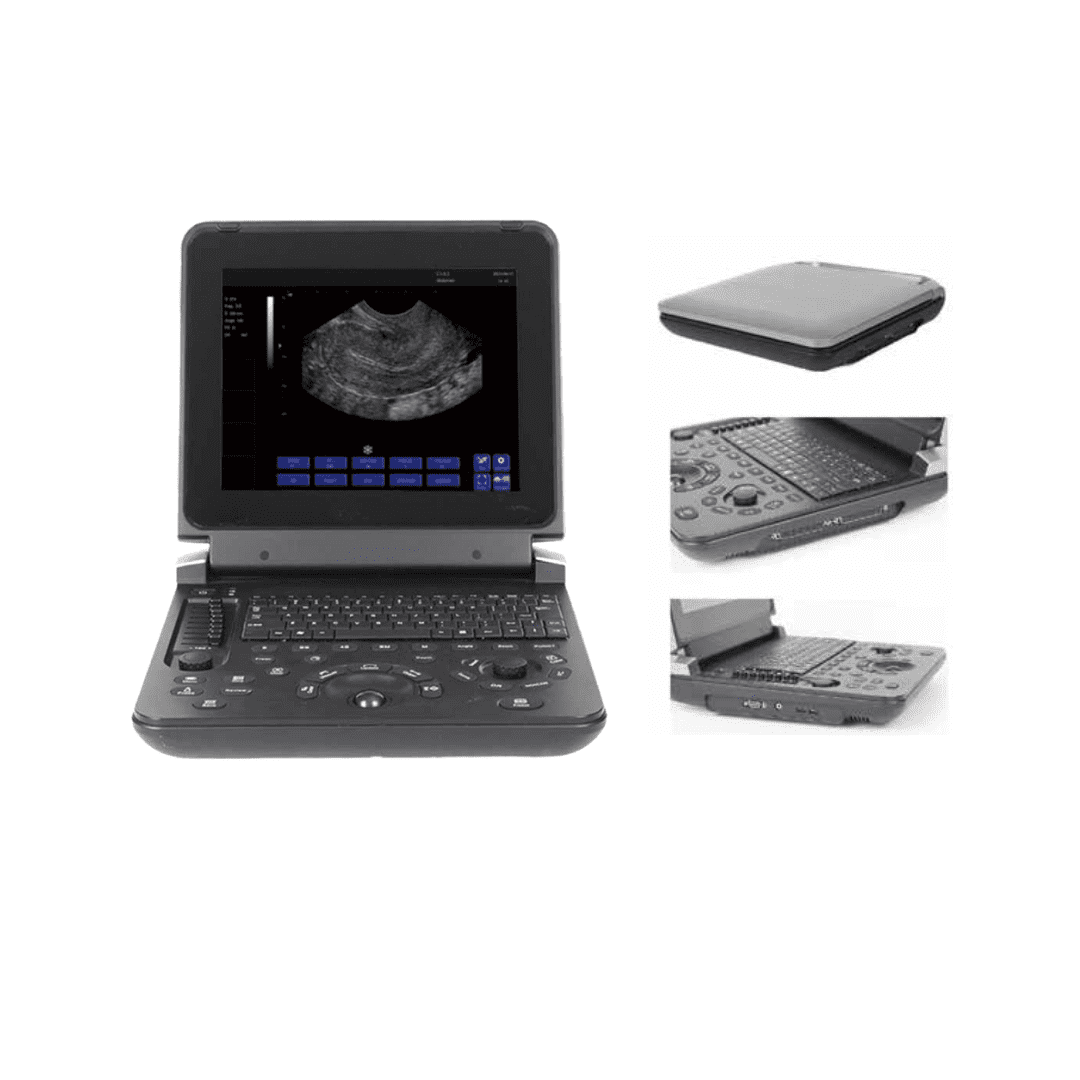 US-121A Ultrasound Machine - 12 Inch