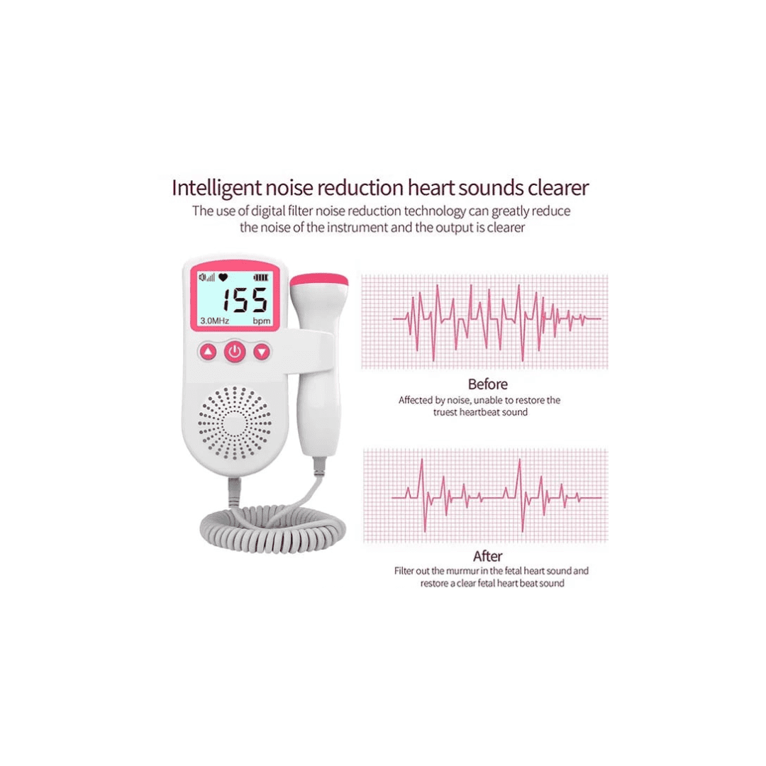 Fetal Doppler - Rechargeable