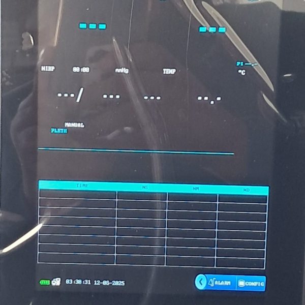 vital signs monitor-E8 8 inch monitor